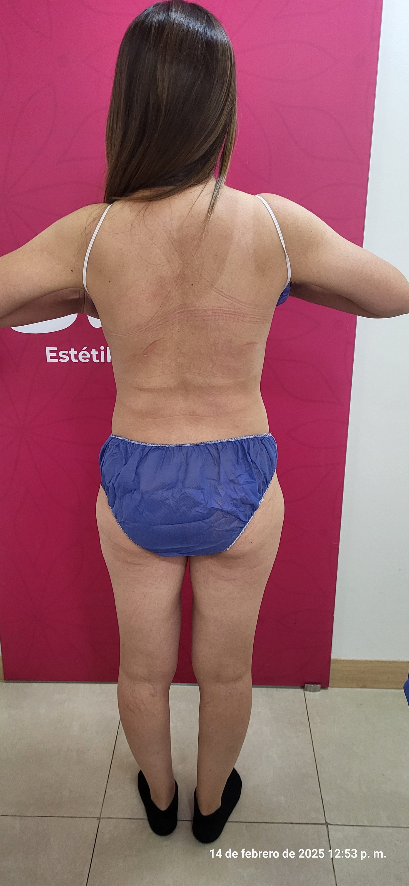 Después del tratamiento Tonificador