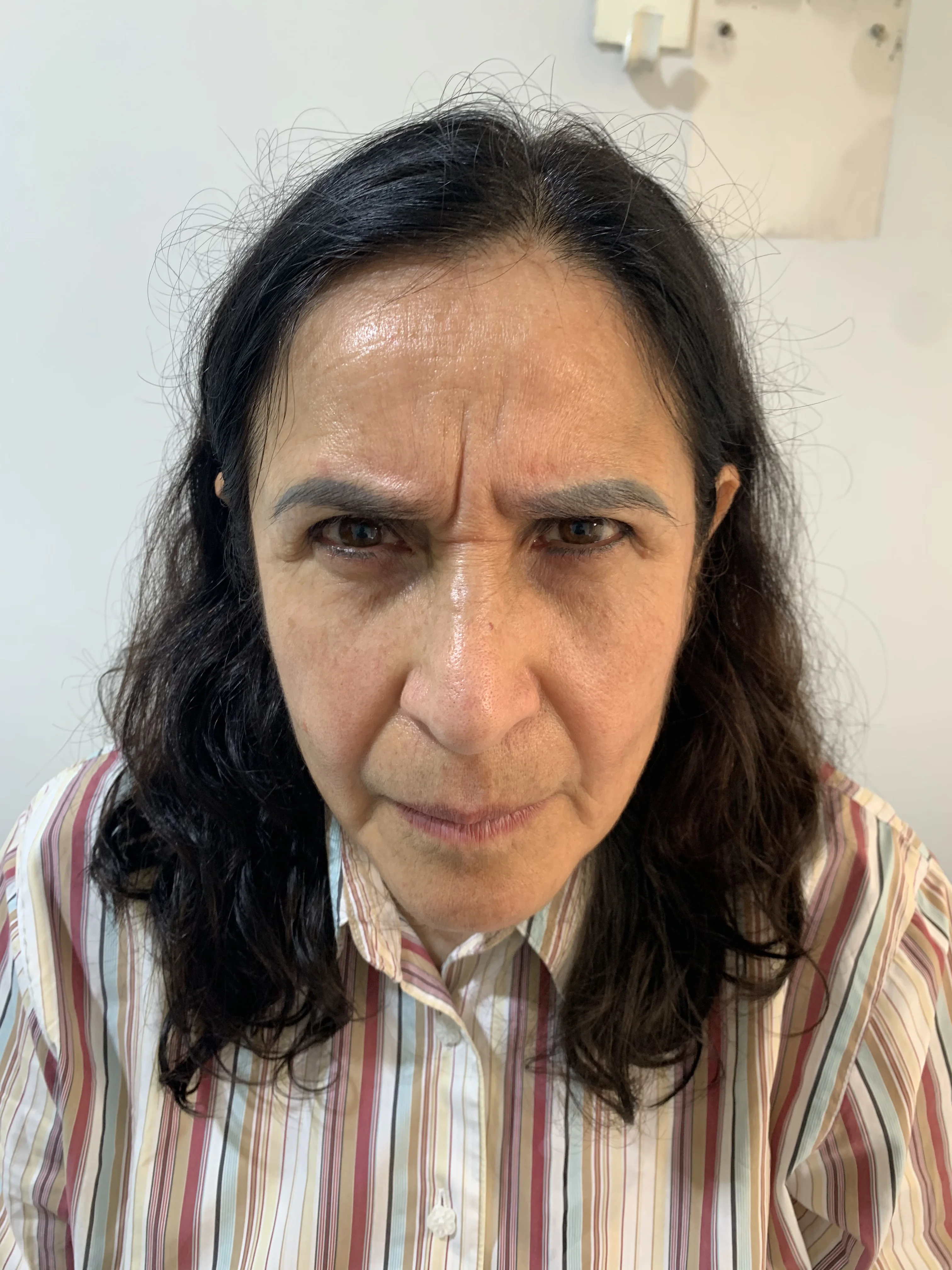 Antes del tratamiento Skin Booster